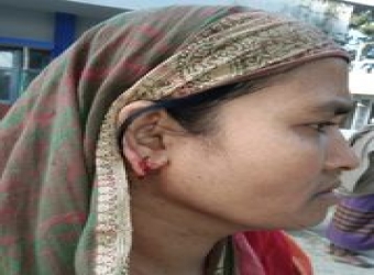 জয়ী প্রার্থীর কান ছিড়ে নিলেন পরাজিত প্রার্থী