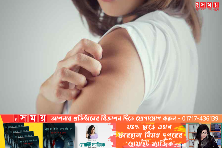 গবেষণা বলছে, শরীরে অ্যালার্জি না থেকেও চুলকানি হতে পারে
