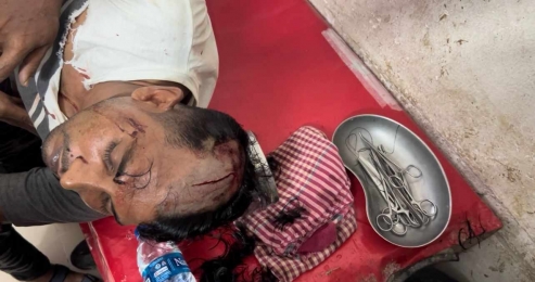 কুয়াকাটায় মোল্লা বাহিনীর সন্ত্রাসী হামলায় গুরুতর আহত ১