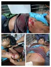 আধিপত্য বিস্তারকে কেন্দ্র করে জাজিরার বিলাশপুরে দফায় দফায়  সংঘর্ষ। 