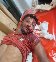 চৌগাছায় বাস থেকে নামতে গিয়ে  চাকার তলে পড়ে হেলপার নিহত