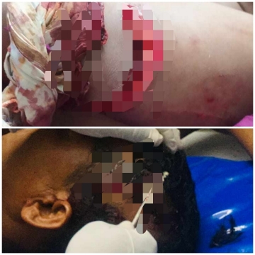 ক্ষেতলাল উপজেলার চেয়ারম্যান প্রার্থীর দুই সমর্থককে কুপিয়ে জখম