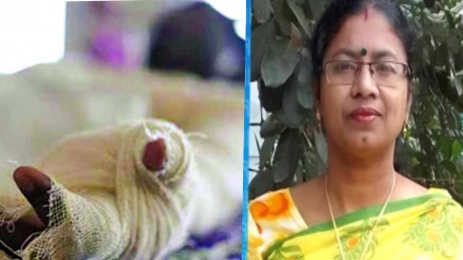 মানিকগঞ্জ এ সেলফি তুলতে গিয়ে অগ্নিদগ্ধ হয়ে এক নারীর মৃত্যু।