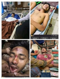 বিলসপুরের সংঘর্ষে প্রাণ গেলো সৈকতের!