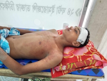 পূর্ব শত্রুতার কারনে হামলা, আহত তিন। 