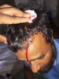 নারায়নগঞ্জের বন্দরে ইসলাম নামের একজনকে  লোহার রড দিয়ে পিটিয়ে রক্তাক্ত জখমের অভিযোগ। 