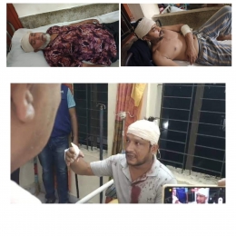 উত্তপ্ত রাজাপুর, দুই উপজেলা চেয়ারম্যান প্রার্থীর সমর্থকদের মধ্যে পাল্টাপাল্টি হামলা, আহত ৩০ 