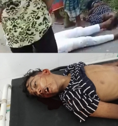 সাটুরিয়ায় মটর সাইকেল মুখোমুখি সংঘর্ষে নিহত ০২ আহত ০৩ জন