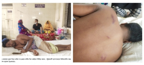 মামলা তুলে নিতে রাজি না হওয়ায় মামলার বাদীর তিন ভাইকে পিটিয়ে জখম।