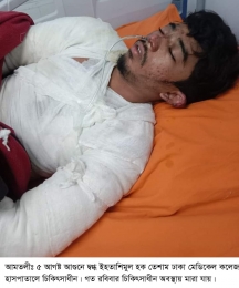 ২৭ দিন মৃত্যুর সঙ্গে পাঞ্জা লড়ে মারা গেলেন আগুনে দগ্ধ স্কুল ছাত্র।