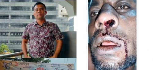 অতর্কিতভাবে যুবদল নেতার হামলা, জখম ওয়ার্ড বিএনপি কর্মী