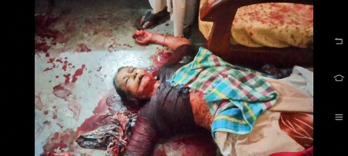 ইউনিয়ন আওয়ামী লীগ নেতার স্ত্রী লুৎফা বেগমকে গলা কেটে হত্যা করার অভিযোগ উঠেছে দুর্বৃত্তের বিরুদ্ধে।