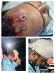 নোয়াখালী বেগমগঞ্জ কৃষি প্রশিক্ষণ ইন্সটিটিউট শিক্ষার্থীদের উপর  স্থানীয় সন্ত্রাসীদের হামলা, আহত ৮ 