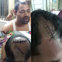 শ্রীবরদীতে প্রতিপক্ষের নৃশংস হামলায় আহত ৪
