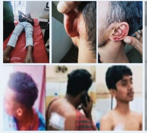 কুমিল্লা’য় ফুটবল খেলাকে কেন্দ্র করে দুই গ্রামবাসীর সংঘর্ষ,আহত-৬