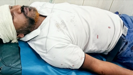 পূবাইলে স্বেচ্ছাসেবক দলনেতার উপর যুবলীগ নেতাদের হামলা থানায় মামলা 