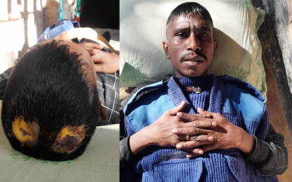 পীরগঞ্জে গ্রাম পুলিশকে পিটিয়ে রক্তাক্ত জখম