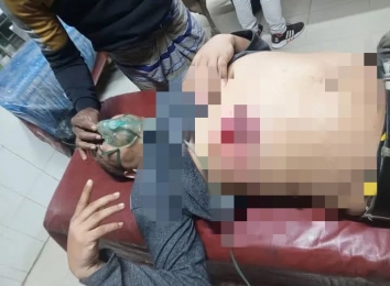 চাঁদাবাজির টাকা নিয়ে বিএনপির দুগ্রুপের সংঘর্ষ, যুবদল নেতা গুলিবিদ্ধ