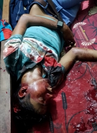 বোন জামাইকে পাথর দিয়ে মাথায় আঘাত করে হত্যার অভিযোগ