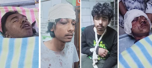 গাজীপুরে মোজাম্মেলের বাড়িতে আহত ৫ জন ঢাকা মেডিকেলে, মাথায়-হাতে গুরুতর আঘাত