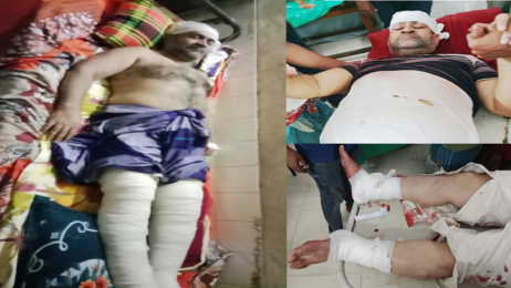 বিশিষ্ট ব্যবসায়ী মঞ্জুর মোর্শেদকে রাতের অন্ধকারে কুপিয়ে জখম করেছে দুর্বৃত্তরা