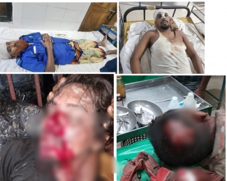 আমতলীতে বাইপাস রাস্তা সংস্কার নিয়ে সংঘর্ষে আহত ১০