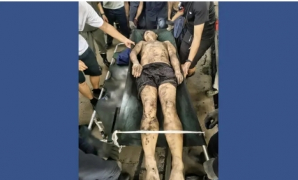 বড়পুকুরিয়া কয়লাখনিতে চীনা শ্রমিক নিহত, ডেটোনেটর বিস্ফোরণে আহত শিশু
