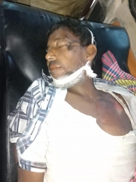সিলেটে টমটম উল্টে গিয়ে মাছ ব্যবসায়ী নিহত 