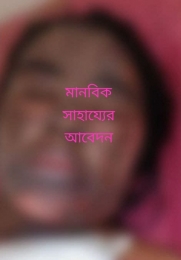 স্বামীর দেয়া আগুনে দগ্ধ সাবানার জন্য মানবিক সাহায্যের আবেদন 
