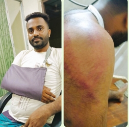  হাতিয়াতে মধ্যযুগীয় কায়দায় নির্মমতাকে হার মানিয়ে গাছের সাথে বেঁধে পেটানো হলো যুবদল নেতাকে।