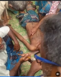 দেওয়ানগঞ্জে সাপের কামড়ে কৃষকের মৃত্যু  অ্যান্টি ভেনামের অভাবে হাসপাতালে মৃত্যু