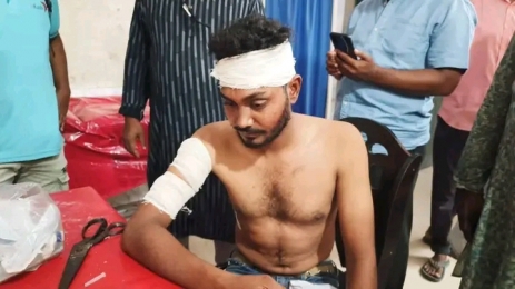 হিলিতে দুর্বৃত্তদের হামলার শিকার বিকাশ কর্মী, লুট দেড় লাখ টাকা