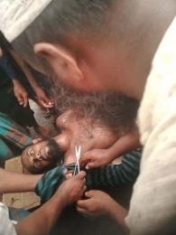 রাস্তার পাশে কাজ করার সময় বজ্রপাত, বকশীগঞ্জে বাবা-ছেলে আহত